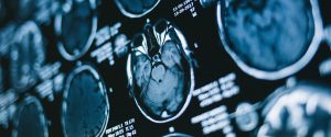 Challenges and Opportunities in Australia’s Radiology Industry