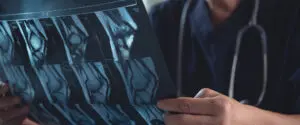 Finding an Orthopedic Surgery Expert Witness